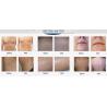 Buy cheap 808nm diode laser epilation desktop machine with permanent hair removal laser handpiece/diode laser producer from wholesalers