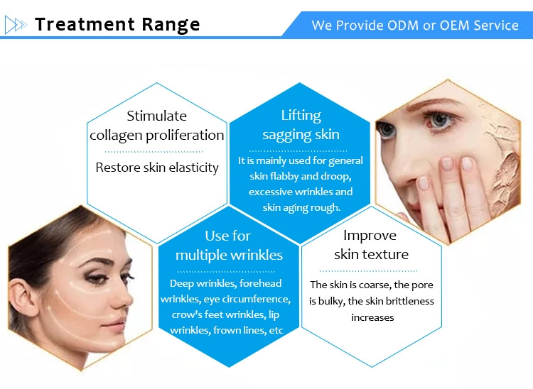 Body Cellulite Removal High Intensity Focused Ultrasound Machine