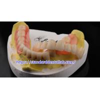 Buy cheap High Esthetics Dental TCS Valplast Flexible Partial Dentures Dental Lab Valplast product