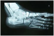 Quality 13in x 17in Degradable X Ray Diagnostic Imaging Medical Paper For Laser Printer for sale