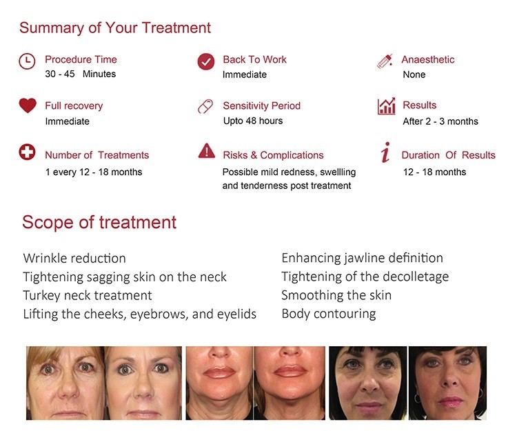 1-10 lines 3D hifu for beauty facial And Body Lifting salon and clinic use with 20000 shots