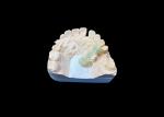 Natural Color Zirconia Dental Crown Crack Resistant For A Flawless Smile from