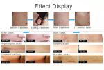 RF 10600nm 10.6um Fractional Co2 Laser female intimate areal Tightening Machine