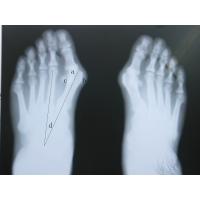 Buy cheap Bright Tone X Ray Medical Imaging Film 8in x 10in , AGFA Drystar Film product