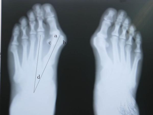 Buy cheap Waterproof X Ray Diagnostic Imaging from wholesalers