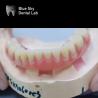 Buy cheap Acrylic Denture Dental Titanium Bar With Attachments Silver And Gold from wholesalers