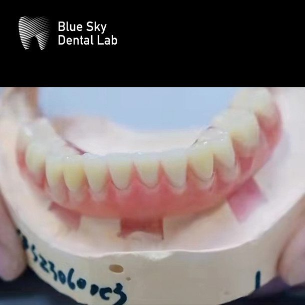 Removable Locator Attachment Implant Overdenture Titanium Upper Locator Denture