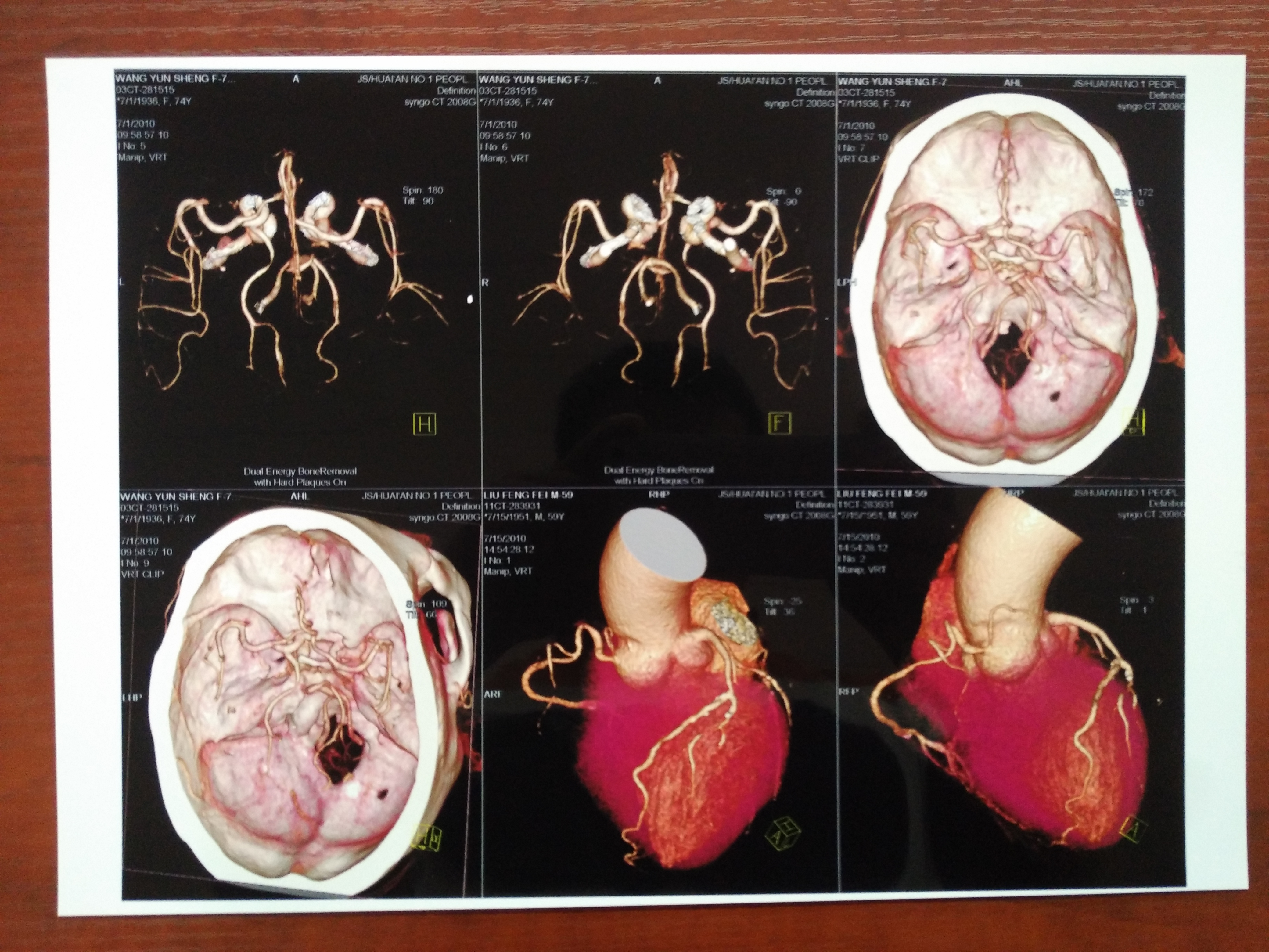 Blue PET Based Thermal Inkjet X Ray Film Medical Images For Clinic Hospitals