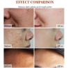 Buy cheap Face Black Freckle Acne Fade Dark Spot Removing Corrector Whitening Cream from wholesalers