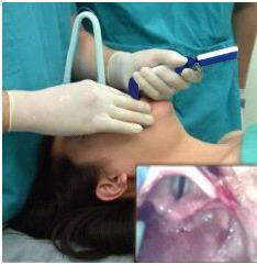 Buy cheap Mac 2 Pediatric Laryngoscope Blade Size For Children Kid Airway Intubation from wholesalers