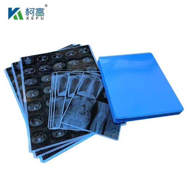 Buy cheap Dicom Software Printing Inkjet X Ray Blue Medical Film For Ct Cr Mr Imaging from wholesalers