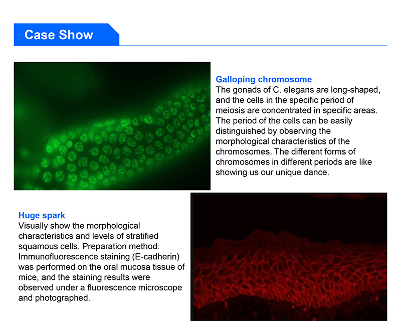 Binocular Wide Field Fluorescence Microscopy A16.2614 40X - 1600X Magnification