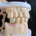 Regular Implant Cases Universal Compatibility Dental Implant Case