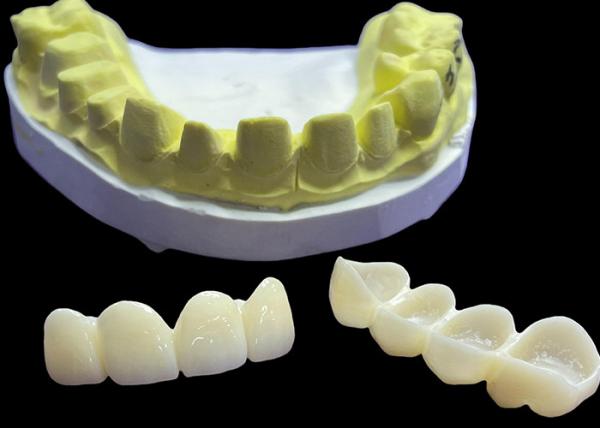 Buy cheap Stain Resistant Dental Porcelain Crowns and Bridges in Vita Classical Shades for Natural Aesthetics from wholesalers