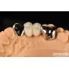 Buy cheap Metallic Dental Maryland Bonded Bridge Good Remediation For Oral Clinical Repair from wholesalers