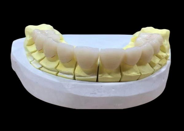 Buy cheap Zirconia porcelain Dental Crown with Aesthetic and Natural-Looking Finish from China dental lab from wholesalers