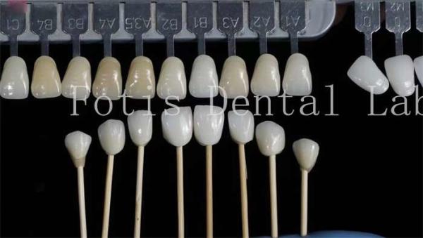 Buy cheap Customization Natural Dental Veneers Fake Teeth Overlays High Strength from wholesalers