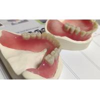Buy cheap Hot Cured Removable Aesthetic Lower Partial Acrylic Denture product