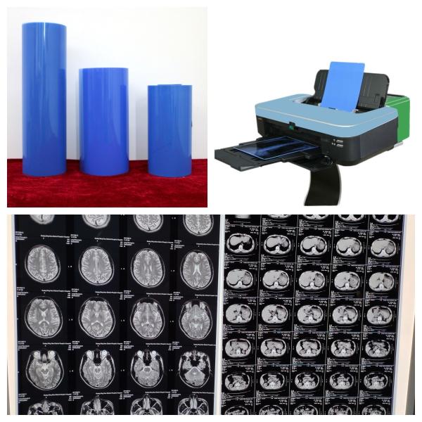 High Durability Inkjet Blue Medical X Ray Film Long Lasting Blue Image