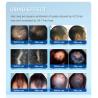 Buy cheap 650nm Lllt Red Light 200 Diode Hair Loss Treatment Laser Helmet Hair Growth from wholesalers