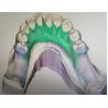 Buy cheap Removable 3D Printed Partial Denture Metal Framework from wholesalers