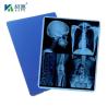 Buy cheap Medical Blue Inkjet Based Dry Imaging Xray Film Pet Blue Base Film For Making X-Ray Film Epson HP Printers from wholesalers
