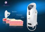 0.5-10HZ Diode Hair Removal Laser Machine / 810nm Lady Hair Removal Machine For