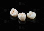 Natural Full Contour Zirconia Crown Precise Fit Full Contour Dental Lab