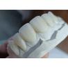 Buy cheap Strength Wear Resistant Ceramic crown Bridge for Comfortable Precise Dental Restoration from wholesalers