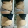 Buy cheap Fat And Cellulite Reduction Machine 230VAC vela shape wtih 4 Handles from wholesalers