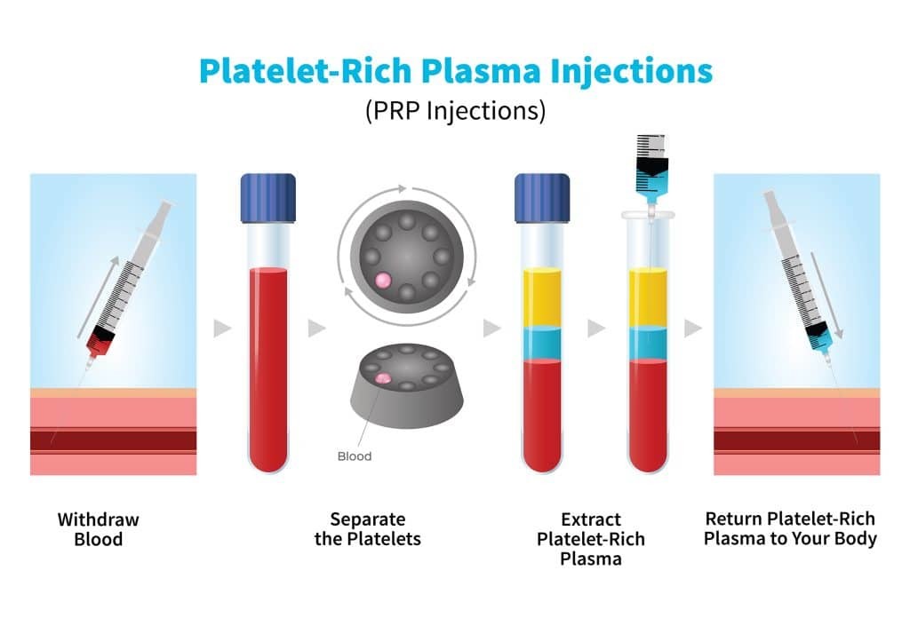 Max. RPM 4000 r/min PRP Centrifuge Machine for 10ml Blood Collection Tube in Medical PRP Treatment