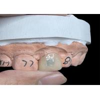 Buy cheap Transform Your Smile Dental EMAX Veneer , Highly Translucent Emax Teeth Veneers product