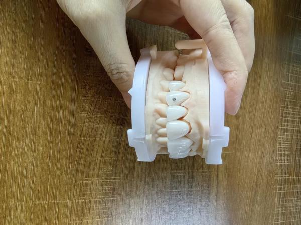 Buy cheap Highly Translucent Zirconia Crowns Bridge Veneers With Customized Jewelry And Gold Beautiful Dental Restoration Case from wholesalers