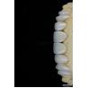 Buy cheap Glossy Surface Texture Feldspathic Veneer Natural Looking Porcelain Veneer from wholesalers