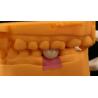 Buy cheap Screw Retained PFZ Porcelain Layered Zirconia Dental Implant Crown from Dental Lab ISO FDA CE Certified with 5-Year Guarantee from wholesalers