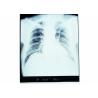 Buy cheap Konida Dry Imaging Film , Medical Paper Laser Imaging Film from wholesalers