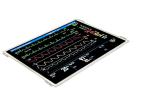 Durable 10.1 Inch TFT LCD Module For Patient Monitor 1024*768 Resolution