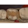 Buy cheap Seamless Porcelain Emax Veneers Teeth Replacement Authentic Looking from wholesalers