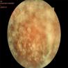Buy cheap FDA Automated Fundus Camera 35mm Fluorescence Angiography from wholesalers