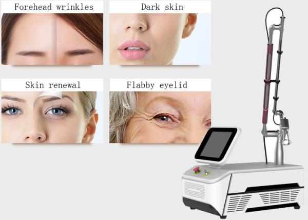 Portable Fractional Co2 Laser Equipment Carbon Dioxide Lasers For Wrinkle