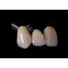 Buy cheap High Strength Zirconia Dental Crown For Single Or Multiple Teeth Replacement from wholesalers