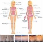 Rechargeable VCA IPL Hair Removal Machine 808nm Ellipse IPL Machine