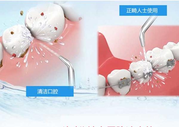 Buy cheap High Frequency Personal Care Products 3 Modes Electric Dental Cleaning Devices from wholesalers