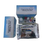 Medical Diagnostics HBsAb Elisa Test Reagents OEM Packing
