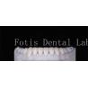 Buy cheap High Durability Natural Looking Teeth Veneers 0.3mm-0.5mm Thickness from wholesalers
