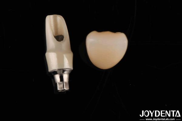 Zirconia Custom Abutments And Bars Dental Restorations For Individual Patient's