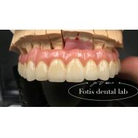 Buy cheap Reliable Restoration PFM Dental Crowns Porcelain Fused To Metal Crown Customized product