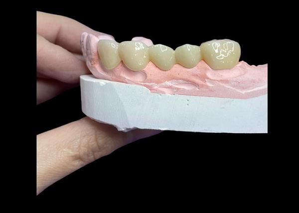 Buy cheap All Ceramic Crowns and Bridges Designed for Superior Aesthetics Durability and Natural Fit for Long-Lasting Confidence from wholesalers