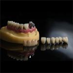 Dentists Cad Cam PFM Crown Ceramic Material Metal Foundation