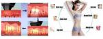 10 years manufacturer 600W output power 808nm laser hair removal machine for